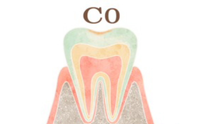 経過観察が必要な程度の歯（C0）のイラスト
