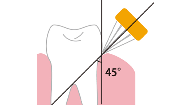 歯と歯ぐきの境目に斜め45度に歯ブラシを当てて磨くバス法のイメージイラスト