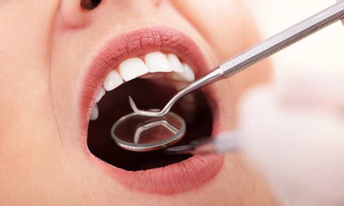 歯科医院で口腔内チェックを受けている様子