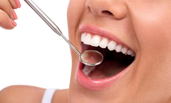 歯科医院で口腔内チェックを受けている様子