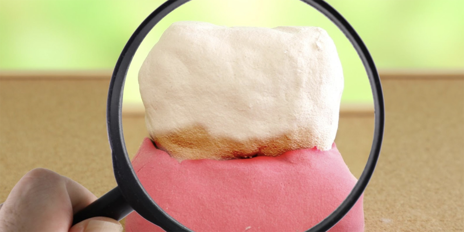 歯の汚れを虫眼鏡でアップしている画像