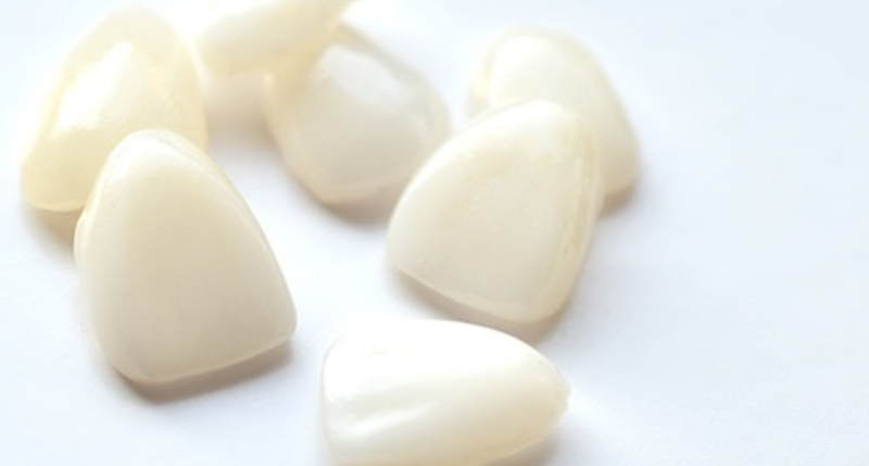 セラミックの歯の画像