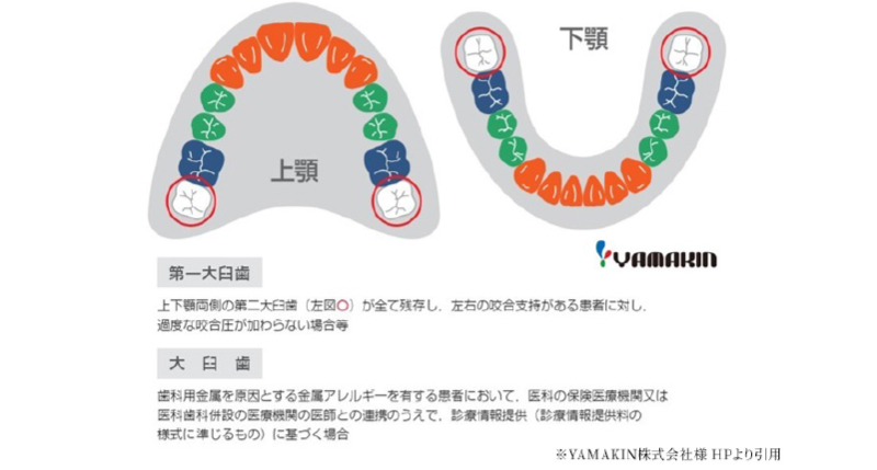 CADCAM冠適用部位についての画像