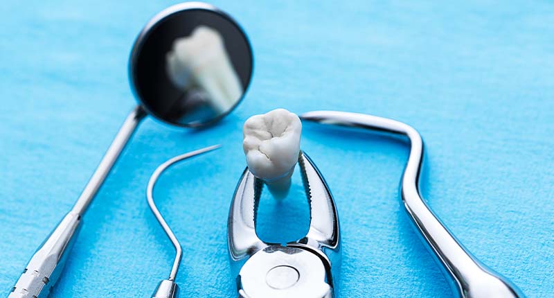 歯を抜くための器具で抜いた歯を掴んでいる